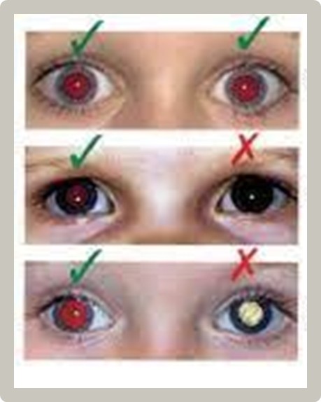 Prueba del Reflejo Rojo